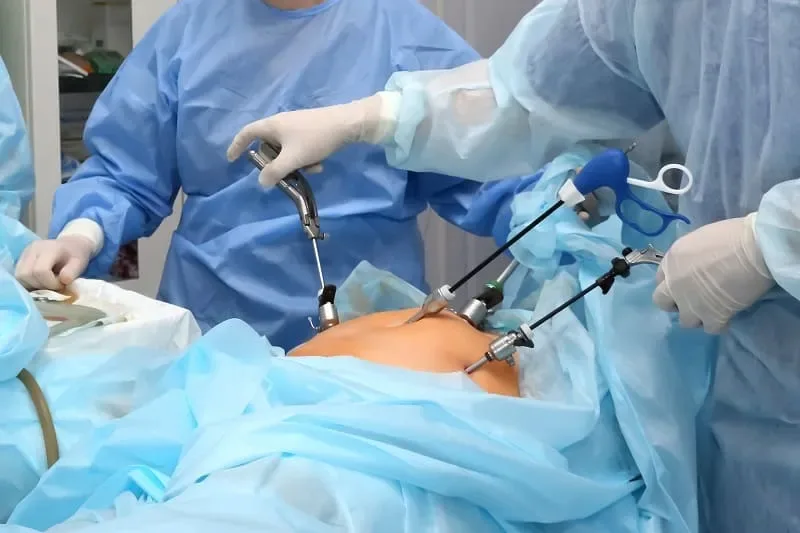 Atención integral de la apendicitis en la CDMX
