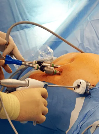 ¿Qué médico realiza cirugía de vesícula?