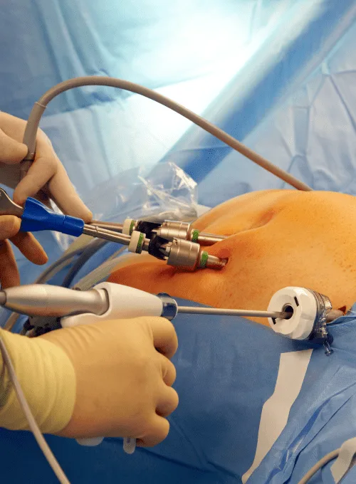 ¿Qué médico realiza cirugía laparoscópica digestiva en la CDMX?