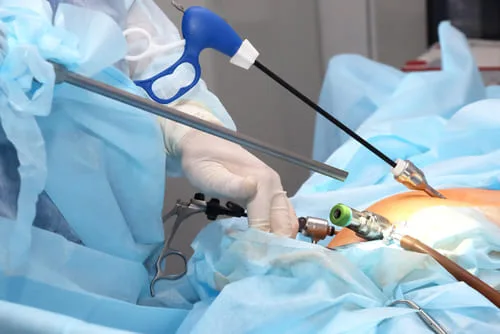 ¿Qué médico trata la colecistitis?