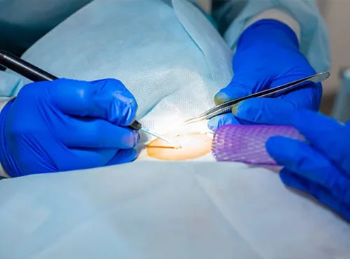 Especialista en resolución de complicaciones abdominales en la CDMX