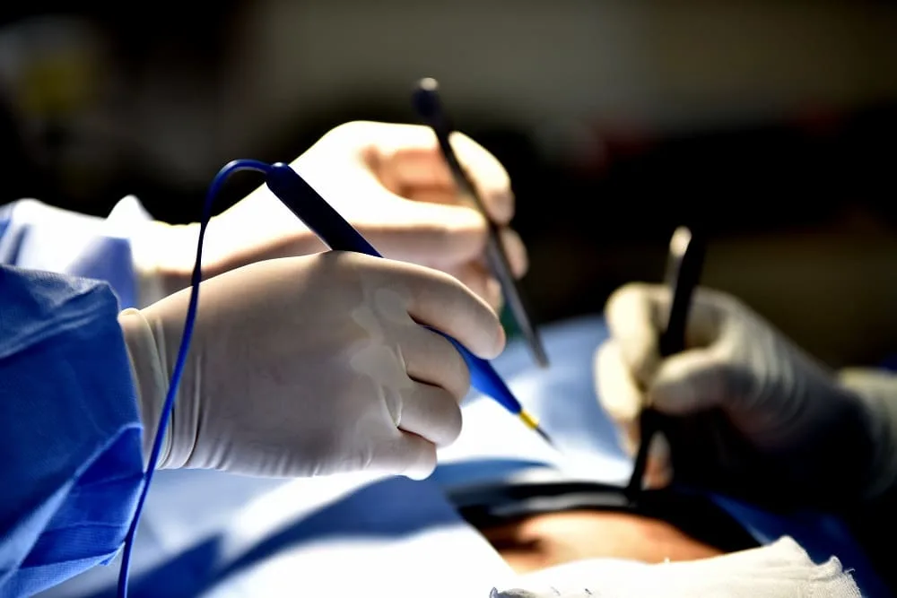 Diverticulitis: Diagnóstico y manejo especializado en la CDMX