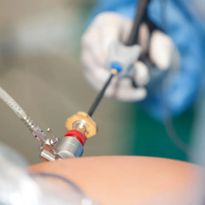 Hernia hiatal: Manejo especializado y cirugía de vanguardia en la CDMX