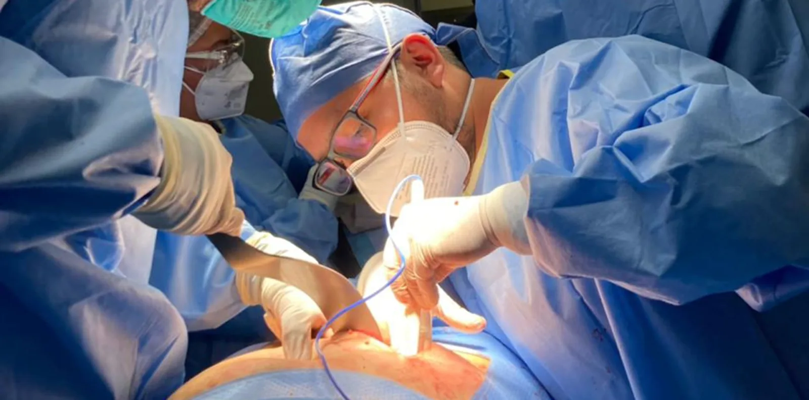 ¿Qué médico trata una hernia hiatal?