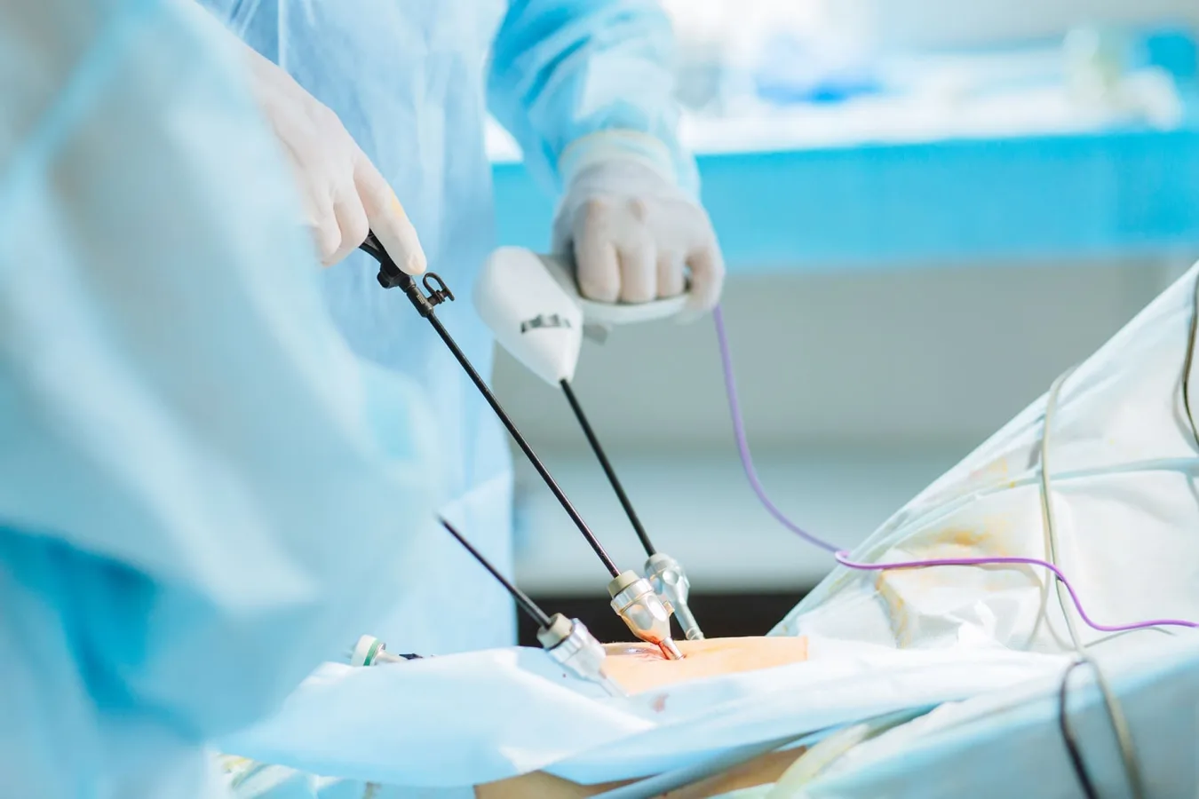 Hernia inguinal: Diagnóstico y reparación especializada en la CDMX