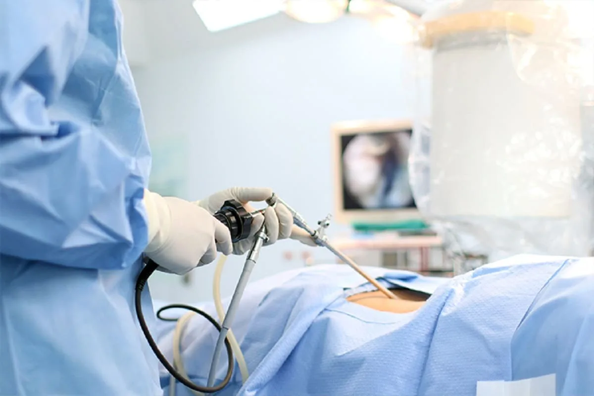 ¿Qué médico trata hernias abdominales?