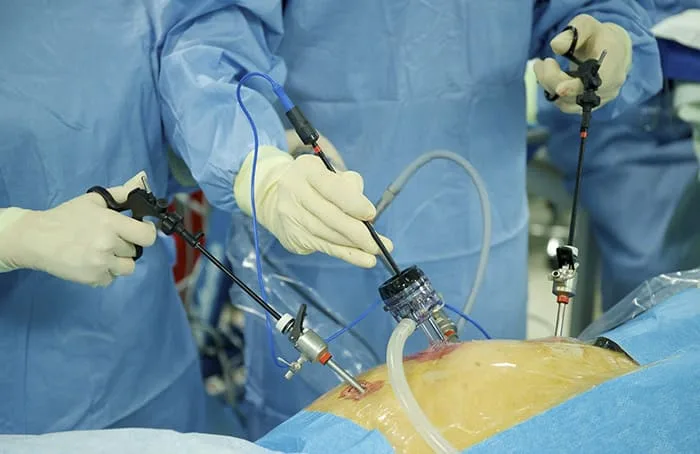 ¿Qué médico trata problemas digestivos quirúrgicos?