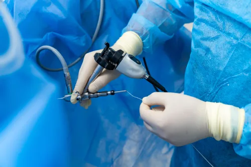 Quistes abdominales: Diagnóstico especializado y cirugía avanzada en CDMX